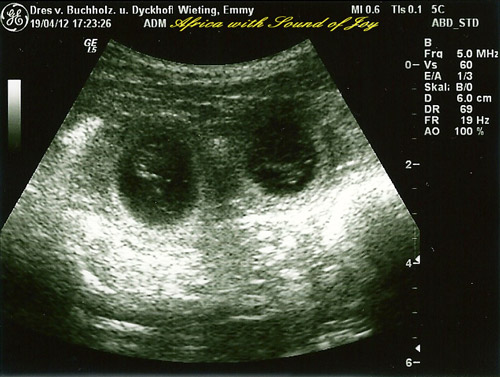 Ultraschall vom 19.04.2012